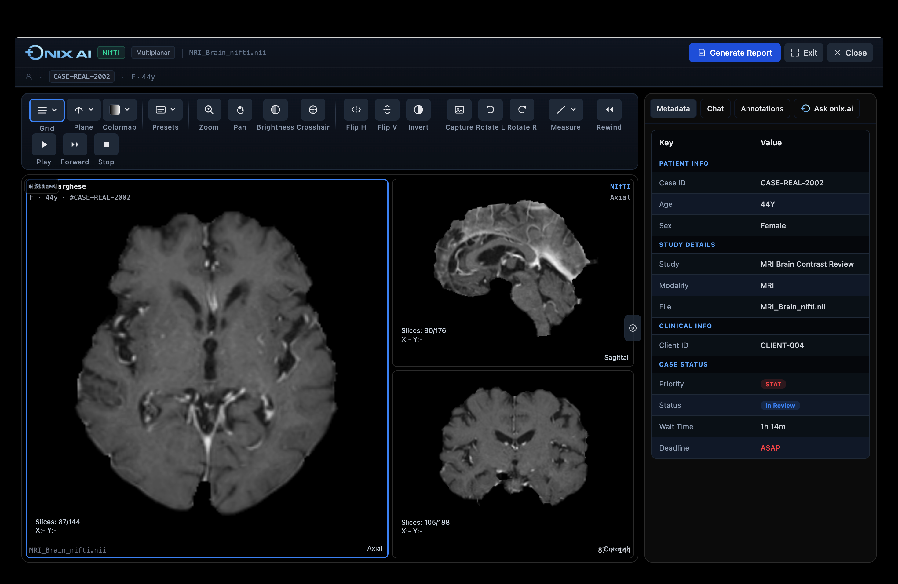DICOM Viewer